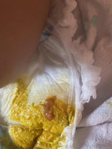 ลูก3 เดือนถ่ายมีมูกเลือด