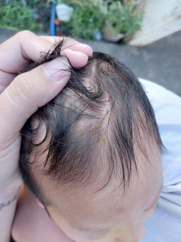 Baby problem