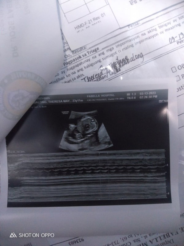 Fetal biometry Ultrasound