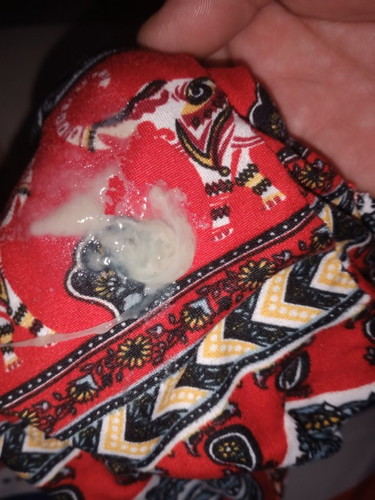 mucus plug