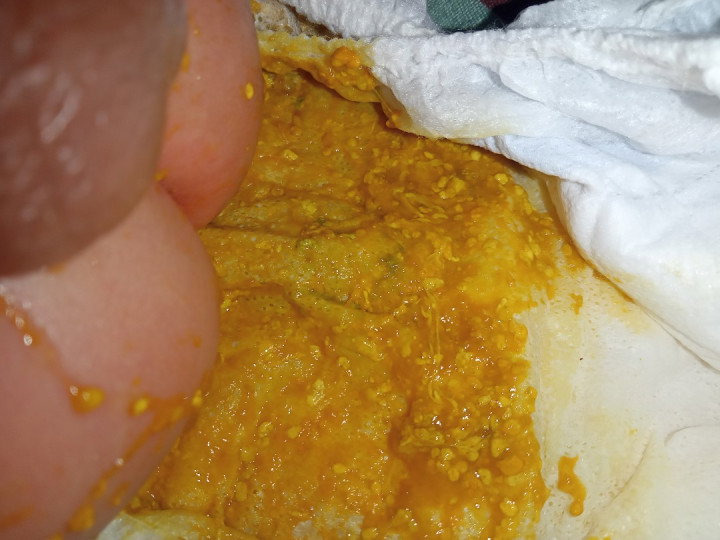 Mucus and seedy poops. No Blood
1 Month and 20 days baby boy.