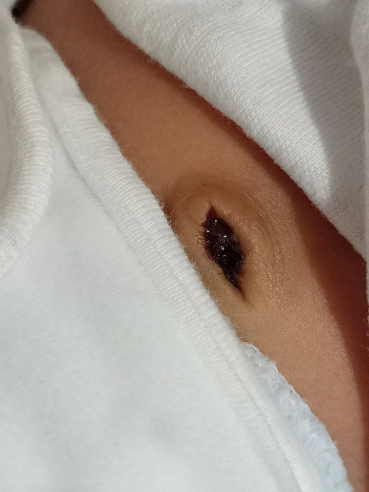 Umbilical Cord