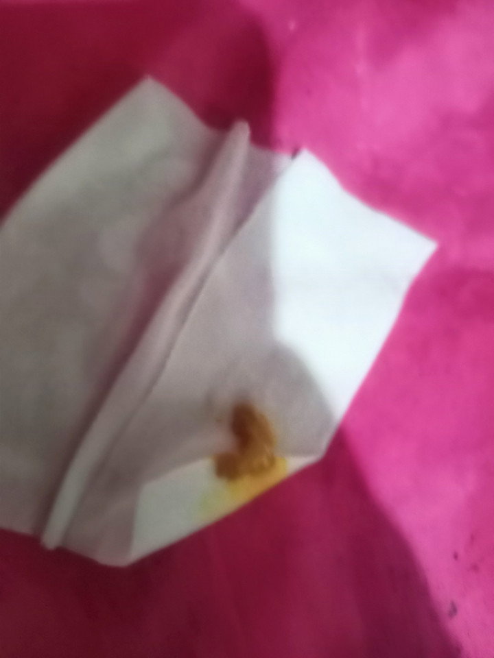 Poop something na lumabas sa private part ni baby
