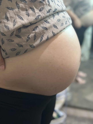 Malaki ang tummy at 25 weeks