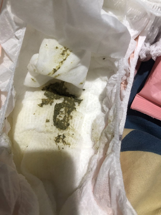 Color green poop