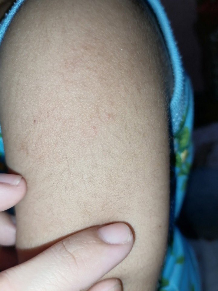Maliit na butlig2