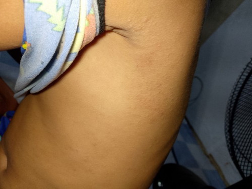 Ano po kaya ito nadami po kasi naggagamot po sya ng Ptb 3 months na