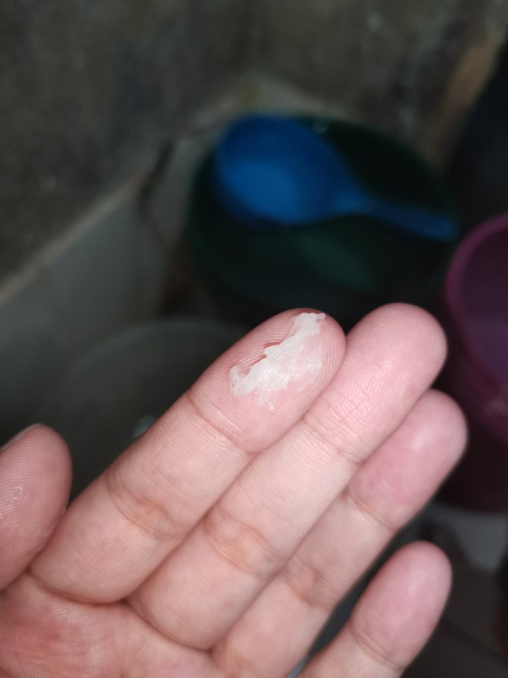 Hello mga mi 35 weeks ako now lagi ako may ganitong discharge.