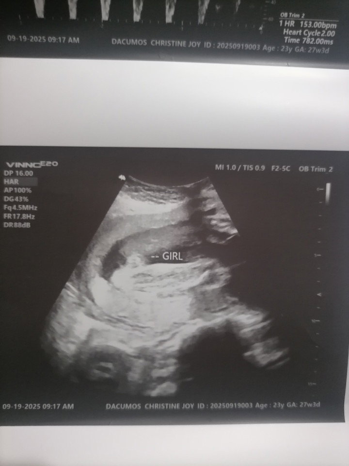 Sure po ba na baby girl mga miii 26 weeks and 4 days po