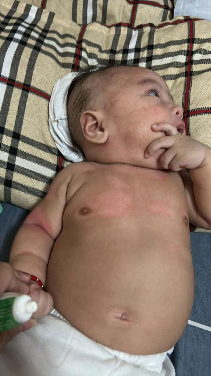 pa help naman po ftm po ako, may redness at rashes po kasi bb ko ano po ma recommend nnyo?