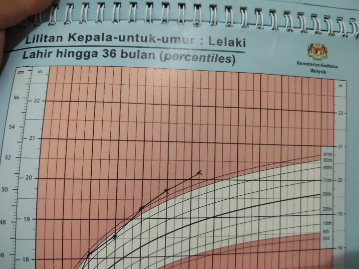 Lilit kepala besar