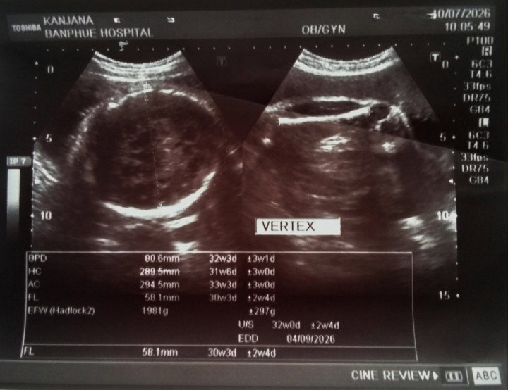 31Week