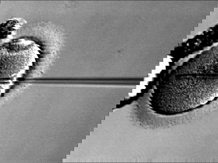 Sperm Injection Intracytoplasmic sperm injection