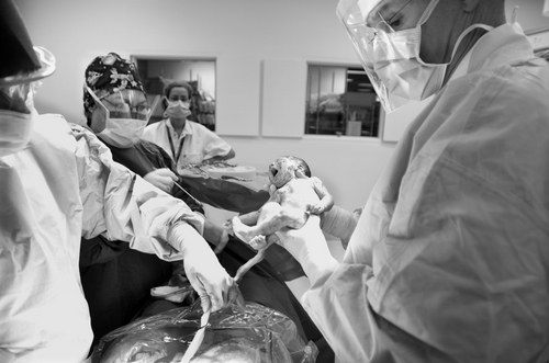 What is a Stillbirth?