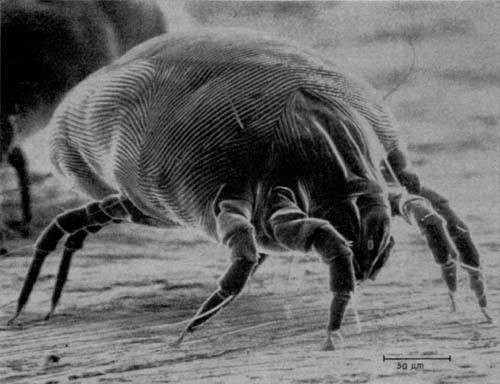 Quick Ways to Get Rid of Dust Mites