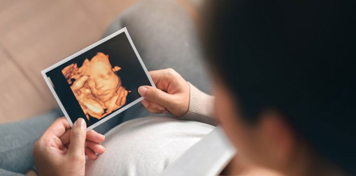 4D Ultrasound: Take a sneak peek at your baby with this!