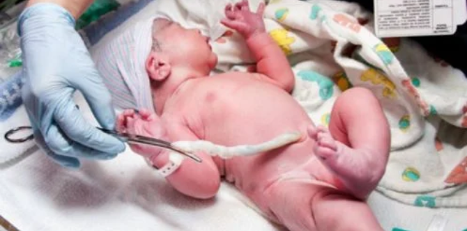 Delayed cord clamping: Is it safe for you and your baby?