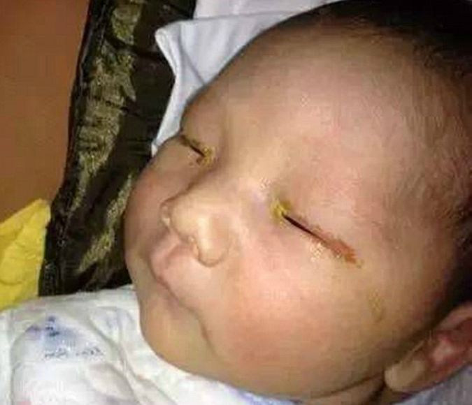 Can A Baby Go Blind From A Camera Flash?