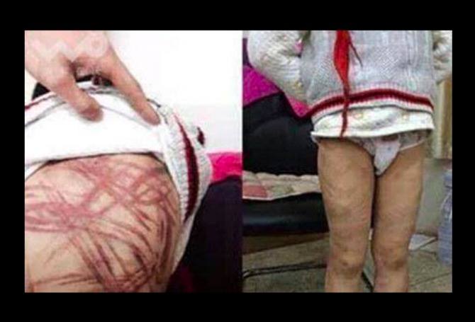 Woman beats up adopted son using a skipping rope