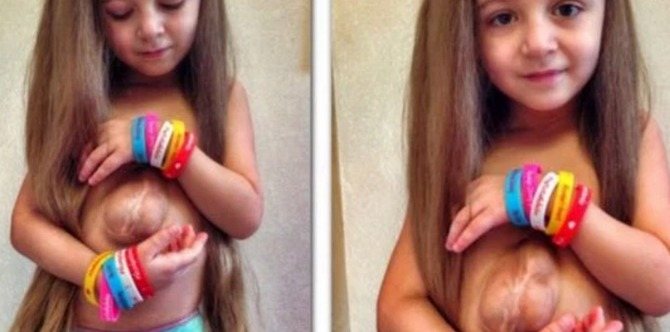 6-year-old girl’s heart beats outside her body…it’s a miracle