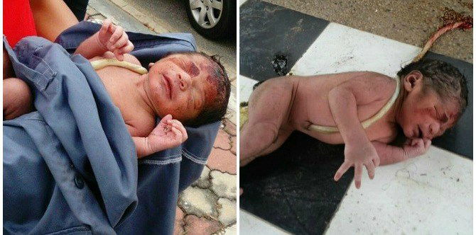Newborn baby with umbilical cord attached left to die in park