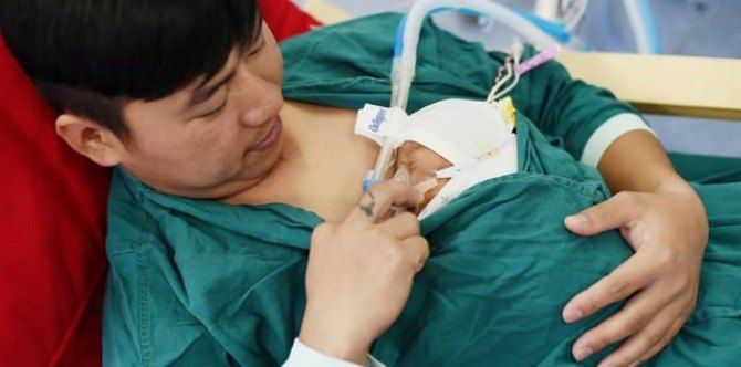 Dads are now bonding with their premature newborns through 'kangaroo care'