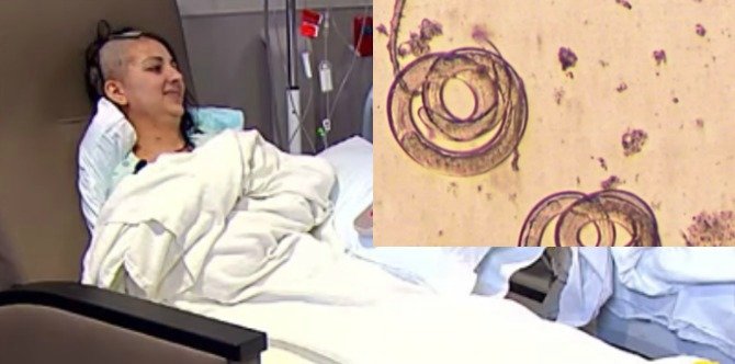 Mom's frequent headaches due to worms in her brain from eating contaminated meat