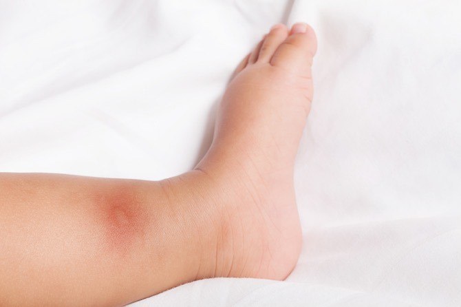 Your Victoria's Secret perfume could be the best mosquito repellant