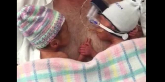 These adorable premature twins holding hands just really love each other