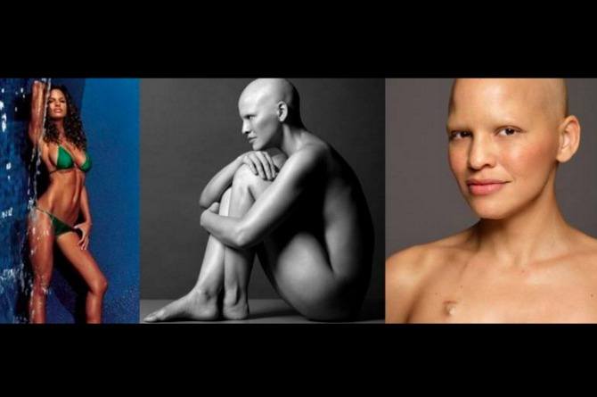 ‘I have stage 3 breast cancer and I have never felt more beautiful in my entire life’