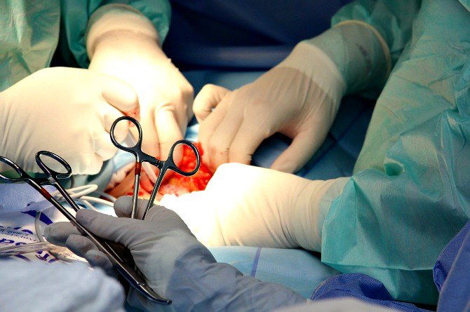11-year-old girl who can’t stop eating her own hair undergoes extreme surgery