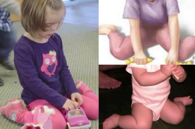 If your child is sitting in the “W” position, stop him right now!