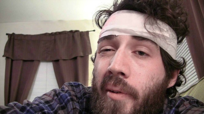 head injury