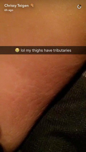 chrissy teigen stretch marks