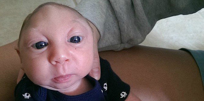 Miracle baby born with most of his skull missing celebrates second birthday