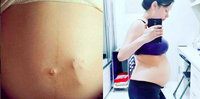 Neri Naig shares scary but amazing baby bump milestone