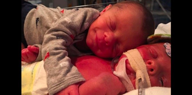 The tragic story behind viral Facebook photo of hugging twins