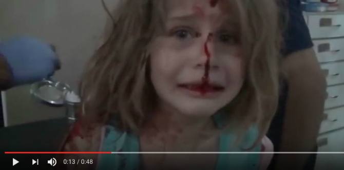 Haunting photo of wounded girl reminds us of the horrors of war