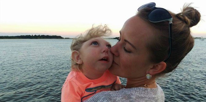 Miracle baby born with just 80% of his brain continues to thrive at 2 years old