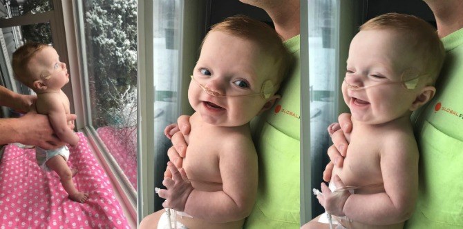 Miracle baby's reaction to seeing her first snowfall will melt your heart