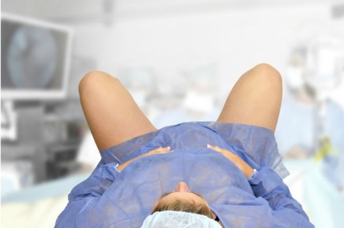 epidural benefits