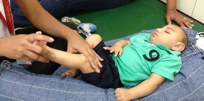 Researchers find that Zika continues to grow in newborn's brains