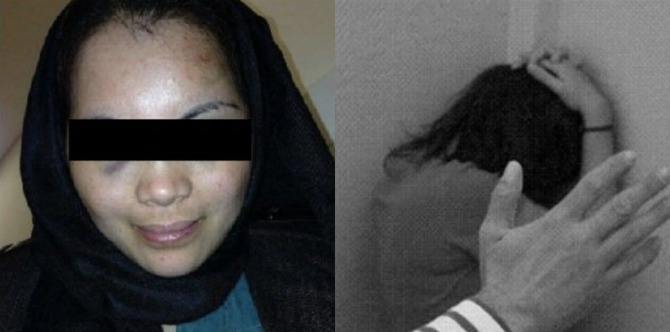 OFW bares domestic abuse she suffered at the hands of her husband