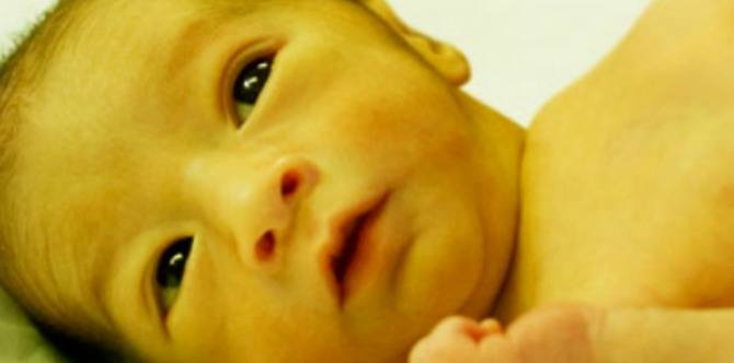Paninilaw ng balat sanggol o infant jaundice: Mga importanteng kaalaman para sa mga magulang