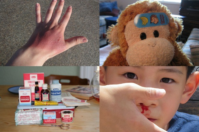 Essential First Aid Tips For Common Household Injuries