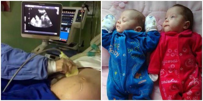 "Miracle" twins born to brain dead mom kept alive on life support