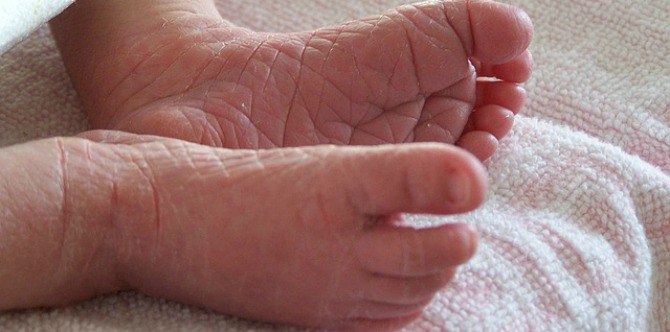 Baby Skin Problems: A Guide For Parents Of Newborns