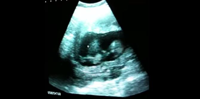 Have you ever wondered what your baby does inside your uterus?