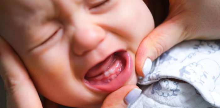 Gamot sa sakit ng ngipin ni baby at mga epekto ng tooth decay