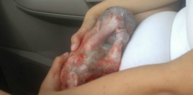 LOOK: Mother captures the amazing moment of her caul birth